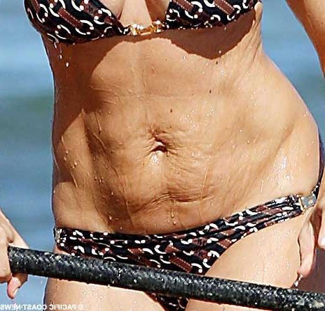 Cindy Crawford Stretch Marks  nude photo