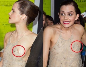 Emma Watson Celebrity Wardrobe Malfunctions  nude photo