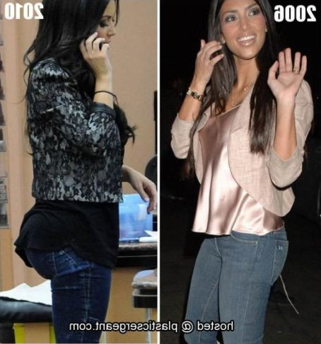 Kim Kardashian Butt Before After  nude photo