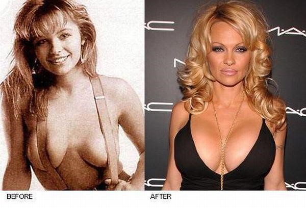 Pamela Anderson Before Implants  nude photo
