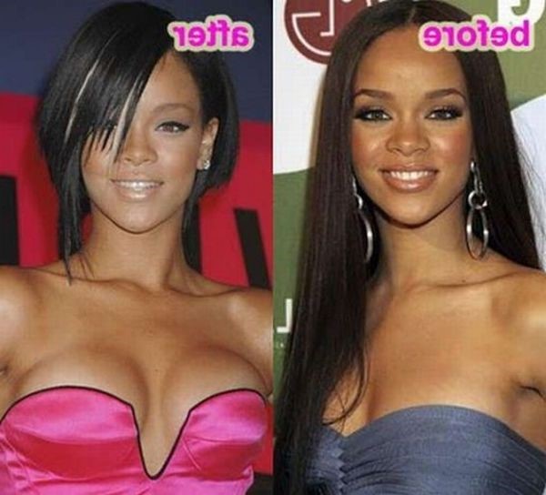 Rihanna Plastic Surgery Before After  nude photo