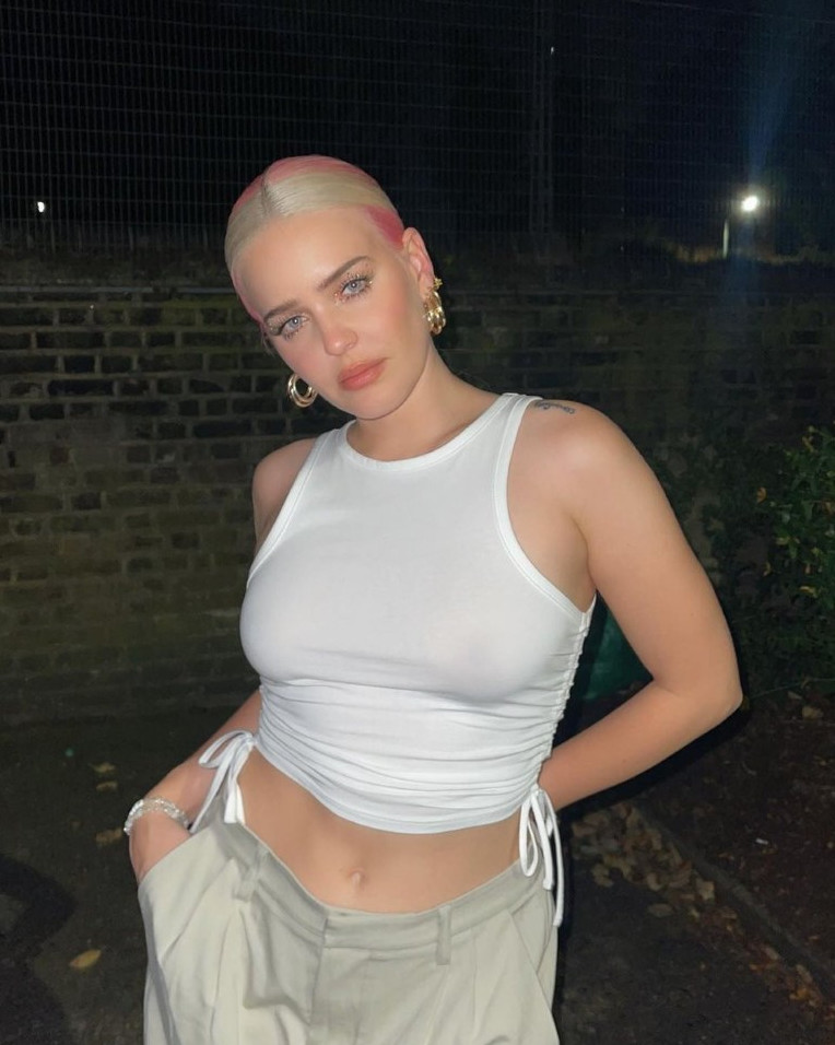 Anne Marie  nude photo